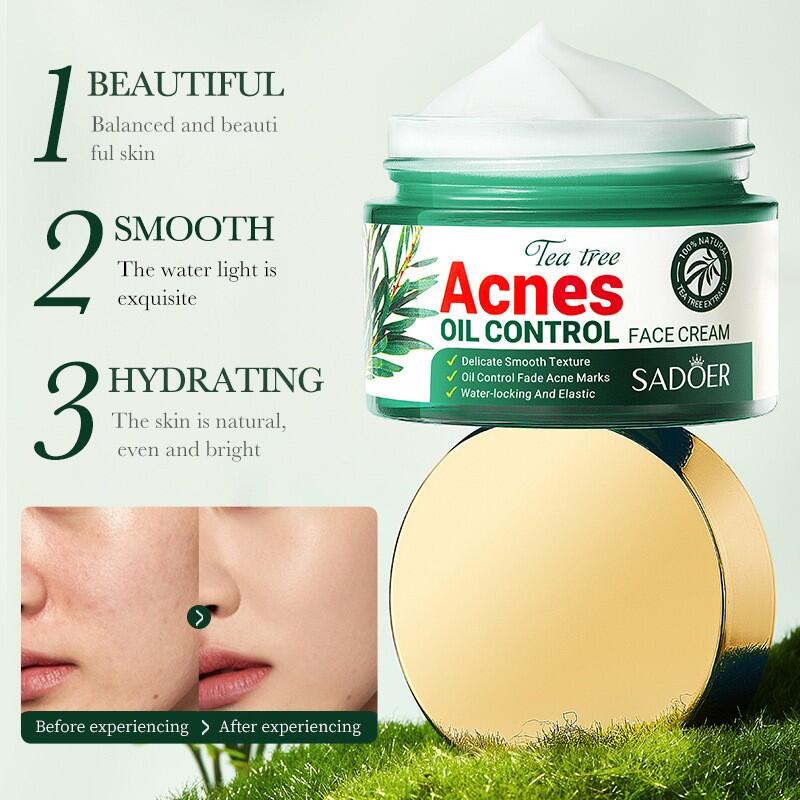 Crema Facial Control del Acné con Aceite de Árbol de Té 50ml SADOER – Purifica, Calma y Regula el Exceso de Grasa
